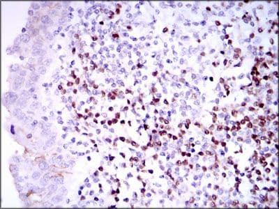 Monoclonal Mouse anti-Human PAX5 Antibody (clone 7D3, Amino Acid: 235-382, IHC, WB)