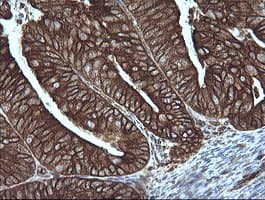 MAP2K1 / MKK1 / MEK1 Antibody (clone OTI4F1)