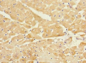 TMOD1 / Tropomodulin 1 Antibody