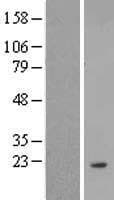 ANKRD37 Protein (Over-Expression Lysate Myc-DDK (Flag))