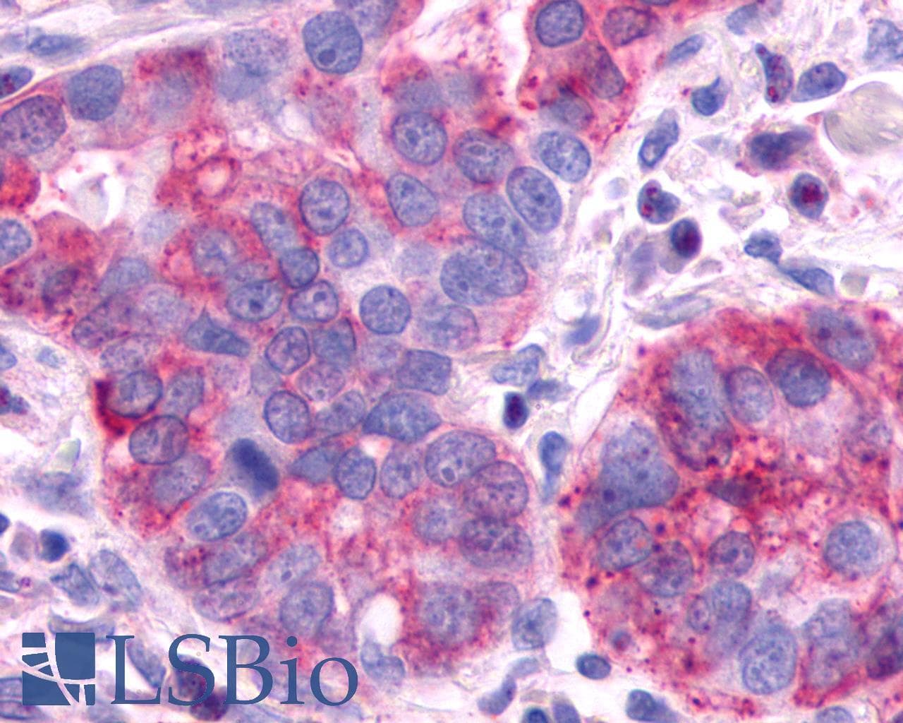 PathPlus™ AVPR2 / V2R Antibody (C-Terminus)