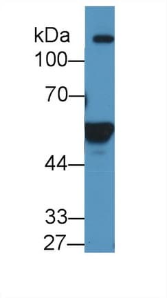 RALDH2 / ALDH1A2 Antibody (aa1-422)