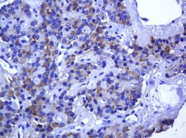 TCL / RHOJ Antibody (clone OTI1A9, Carrier-free)