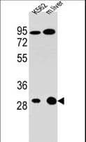 PathPlus™ Polyclonal Rabbit anti-Human ETFA Antibody (aa276-304, IHC, WB)