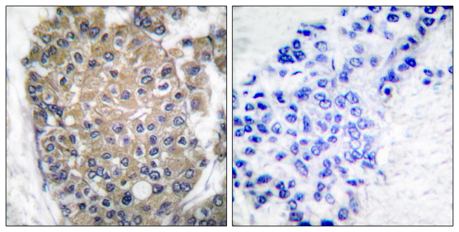 Polyclonal Rabbit anti-Human KRT17 / CK17 / Cytokeratin 17 Antibody (IHC, IF, WB)