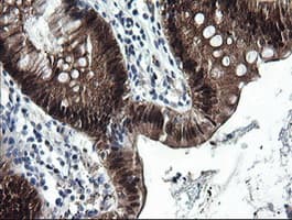 CMPK / CMPK1 Antibody (clone OTI1A1)