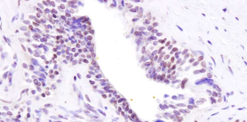 BRD8 Antibody (aa225-275 of isoform 2)