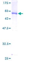 Human DNAJA2 Protein (Recombinant GST)