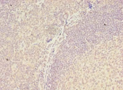ZNF238 Antibody