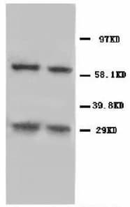 NIP3 / BNIP3 Antibody (N-Terminus)