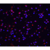 IHC-plus™ IRAK2 / IRAK-2 Antibody