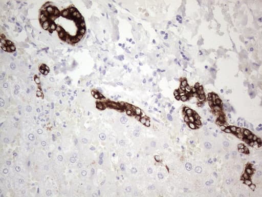 Monoclonal Mouse anti-Human KRT19 / CK19 / Cytokeratin 19 Antibody (clone UMAB188, aa240-390, IHC, IF, WB)
