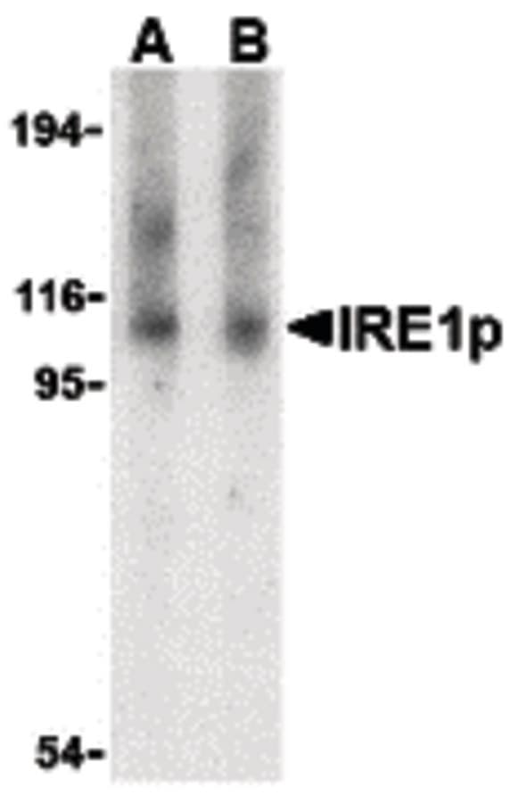 Polyclonal Rabbit anti-Human ERN1 / IRE1 Antibody (WB)