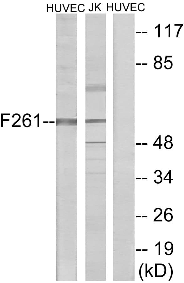 PFKFB1 Antibody (aa406-455)