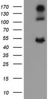 CA12 / Carbonic Anhydrase XII Antibody (clone OTI4D1)