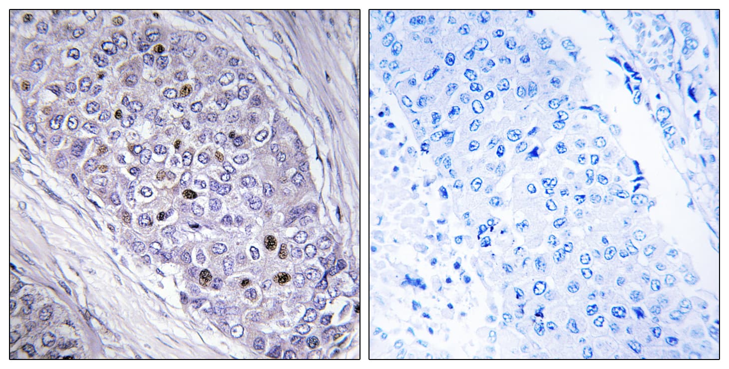 MEF2C Antibody (aa411-460)