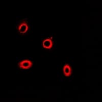 IHC-plus™ HIP1 Antibody