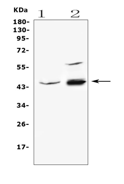ADA / Adenosine Deaminase Antibody