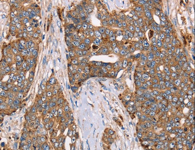 Polyclonal Rabbit anti-Human Alpha Fucosidase / FUCA1 Antibody (IHC, WB)