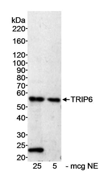 ZRP-1 / TRIP6 Antibody (aa100-150)