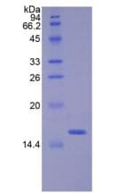 Mouse Angiogenin / ANG Protein (Recombinant 6His, N-terminus)