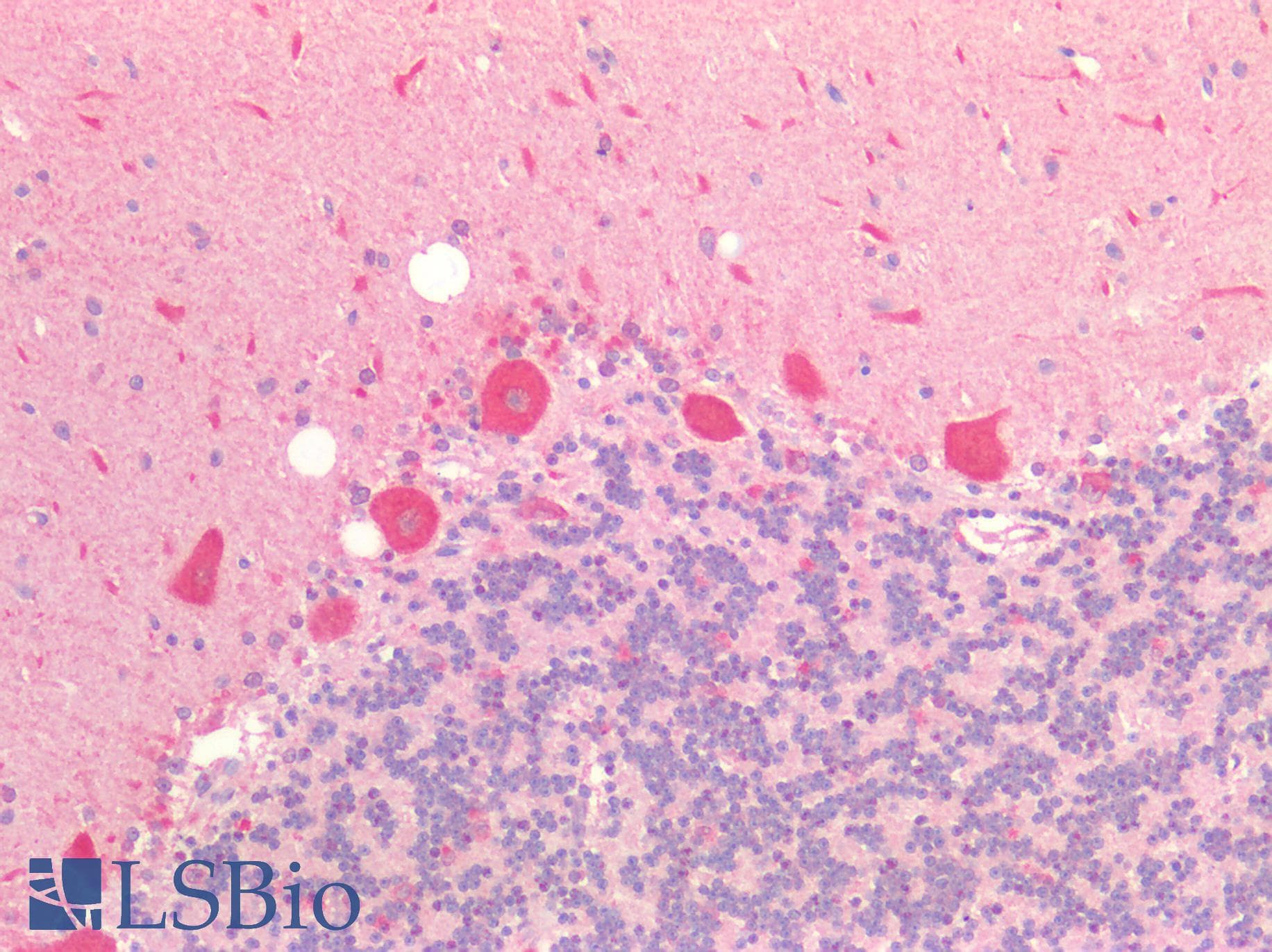 PathPlus™ Polyclonal Rabbit anti-Human 5-Alpha Reductase / SRD5A1 Antibody (IHC)