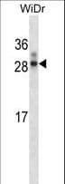 IHC-plus™ Polyclonal Rabbit anti-Rat HOXA7 Antibody (aa1-30, IHC, WB)
