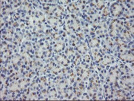 MDM4 / MDMX Antibody (clone OTI2C1)