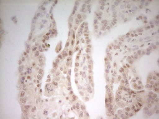 Monoclonal Mouse anti-Human MED15 / ARC105 Antibody (clone OTI1D5, Carrier-free, aa393-679, IHC, WB)
