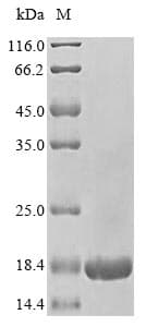 Human RPLP2 Protein (Recombinant 6His, N-terminus)