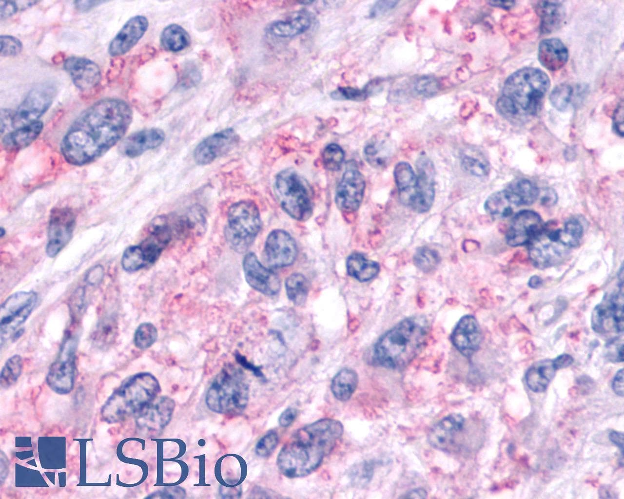 PathPlus™ GPR161 Antibody (N-Terminus)