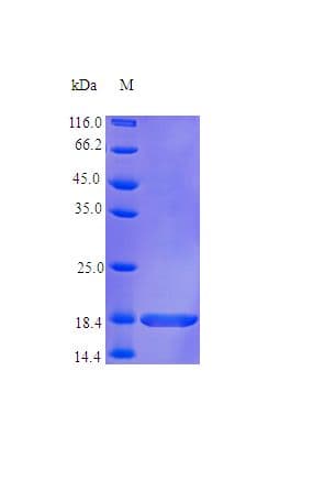 Human TNFRSF13B / TACI Protein (Recombinant)
