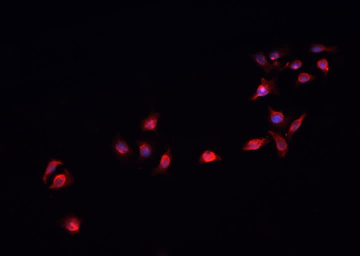 SMAD2 Antibody