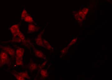 Polyclonal Rabbit anti-Human STAT4 Antibody (phospho-Tyr693, IHC, IF, WB)