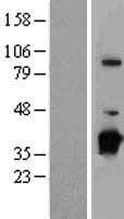 Human NBP / NUBP1 Protein (Over-Expression Lysate Myc-DDK (Flag))
