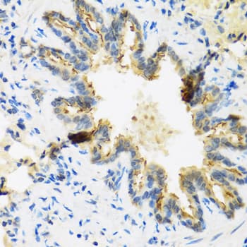 DEFB4A / BD-2 Antibody