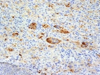 TNF Alpha Antibody (clone TNFA/1172)