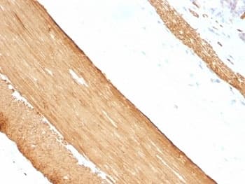 Muscle Actin Antibody (clone HHF35 + MSA/953)
