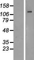 ZEB1 / AREB6 Protein (Over-Expression Lysate Myc-DDK (Flag))