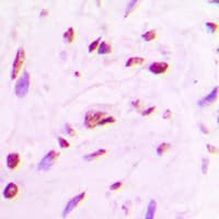 MEF2A / MEF2 Antibody (C-Terminus)