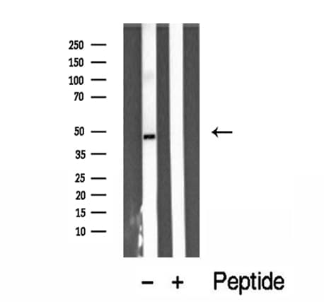 ARL13B Antibody