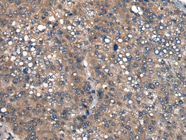 Polyclonal Rabbit anti-Human ICMT / PPMT Antibody (IHC)