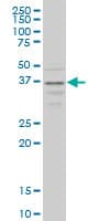 Monoclonal Mouse anti-Human CCR2 Antibody (clone 4D12, WB)