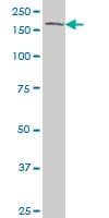 TEK / TIE2 Antibody (clone 3A5)
