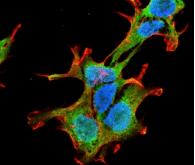 PINK1 Antibody (clone S4-15)