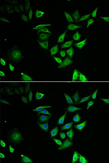 NUTF2 / PP15 Antibody