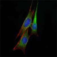 IHC-plus™ ETS1 / ETS-1 Antibody (clone 8A8)