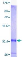 Human MT1M Protein (Recombinant GST)