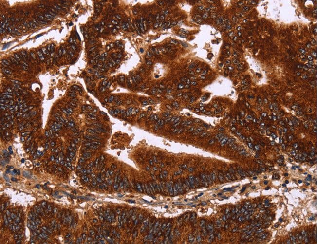 GCKR Antibody