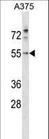 PDCD7 Antibody (aa390-419)